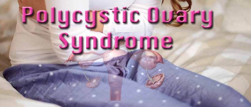 polycystic ovary syndrome